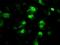 Protein Phosphatase Methylesterase 1 antibody, GTX83847, GeneTex, Immunocytochemistry image 