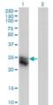Collagen Triple Helix Repeat Containing 1 antibody, H00115908-M05, Novus Biologicals, Western Blot image 
