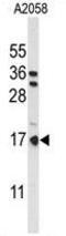Parathymosin antibody, GTX80442, GeneTex, Western Blot image 