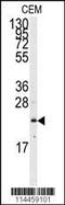 Ras antibody, MBS9213508, MyBioSource, Western Blot image 