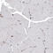 Lysosomal Associated Membrane Protein 1 antibody, AMAb91301, Atlas Antibodies, Immunohistochemistry paraffin image 