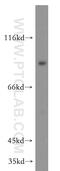 Delta Like Canonical Notch Ligand 1 antibody, 20230-1-AP, Proteintech Group, Western Blot image 