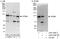 ATM Interactor antibody, A303-399A, Bethyl Labs, Immunoprecipitation image 