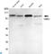Ubiquitin Like With PHD And Ring Finger Domains 1 antibody, LS-C813147, Lifespan Biosciences, Western Blot image 