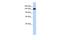 Gse1 Coiled-Coil Protein antibody, A11186, Boster Biological Technology, Western Blot image 