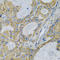 Toll Like Receptor 7 antibody, LS-C331192, Lifespan Biosciences, Immunohistochemistry paraffin image 