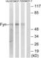 FYN Proto-Oncogene, Src Family Tyrosine Kinase antibody, abx012771, Abbexa, Western Blot image 