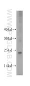 Glucosamine-Phosphate N-Acetyltransferase 1 antibody, 16282-1-AP, Proteintech Group, Western Blot image 