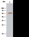 Aldehyde Dehydrogenase 7 Family Member A1 antibody, GTX02097, GeneTex, Immunoprecipitation image 