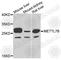 Methyltransferase Like 7B antibody, A7200, ABclonal Technology, Western Blot image 