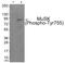 Muscle, skeletal receptor tyrosine-protein kinase antibody, 79-946, ProSci, Western Blot image 