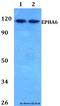 EPH Receptor A6 antibody, A08818-2, Boster Biological Technology, Western Blot image 