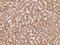 EPH Receptor A3 antibody, 310438-T08, Sino Biological, Immunohistochemistry paraffin image 