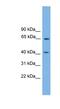 Pleckstrin Homology Domain Containing O1 antibody, NBP1-56986, Novus Biologicals, Western Blot image 