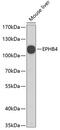 EPH Receptor B4 antibody, 19-024, ProSci, Western Blot image 