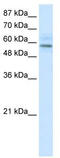 Transmembrane Protein 175 antibody, TA335430, Origene, Western Blot image 