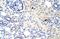 Distal-Less Homeobox 3 antibody, PA5-40506, Invitrogen Antibodies, Immunohistochemistry paraffin image 