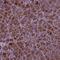 AP-5 complex subunit beta-1 antibody, PA5-64344, Invitrogen Antibodies, Immunohistochemistry frozen image 