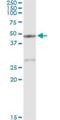 Carboxypeptidase A1 antibody, H00001357-M01, Novus Biologicals, Immunoprecipitation image 