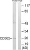CD302 antigen antibody, TA314992, Origene, Western Blot image 
