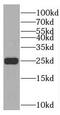 Troponin I1, Slow Skeletal Type antibody, FNab08837, FineTest, Western Blot image 