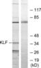 Kruppel Like Factor 1 antibody, LS-C119016, Lifespan Biosciences, Western Blot image 