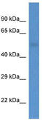 GPAT4 antibody, TA343066, Origene, Western Blot image 