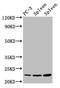 Histone Cluster 1 H1 Family Member E antibody, LS-C670385, Lifespan Biosciences, Western Blot image 