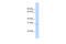 Transcription Factor A, Mitochondrial antibody, 28-598, ProSci, Western Blot image 