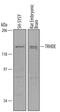 Thyrotropin Releasing Hormone Degrading Enzyme antibody, PA5-47429, Invitrogen Antibodies, Western Blot image 