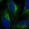 VPS53 Subunit Of GARP Complex antibody, PA5-55079, Invitrogen Antibodies, Immunofluorescence image 