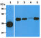 Acyl-CoA Thioesterase 8 antibody, GTX57615, GeneTex, Western Blot image 