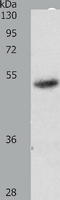 Retinoic acid receptor alpha antibody, TA321250, Origene, Western Blot image 