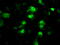 Protein Phosphatase Methylesterase 1 antibody, M08083, Boster Biological Technology, Immunofluorescence image 