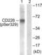 CD226 Molecule antibody, LS-C198755, Lifespan Biosciences, Western Blot image 