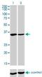 Fragile X Mental Retardation 1 antibody, H00002332-M01, Novus Biologicals, Western Blot image 