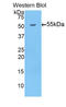 Beta-Secretase 1 antibody, LS-C292998, Lifespan Biosciences, Western Blot image 