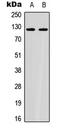 ATP Citrate Lyase antibody, LS-C358894, Lifespan Biosciences, Western Blot image 