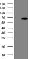 Ankyrin Repeat And SOCS Box Containing 2 antibody, M06285, Boster Biological Technology, Western Blot image 