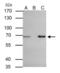 Zeta Chain Of T Cell Receptor Associated Protein Kinase 70 antibody, PA5-28697, Invitrogen Antibodies, Immunoprecipitation image 