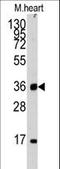 Unc-51 Like Kinase 3 antibody, LS-C101224, Lifespan Biosciences, Western Blot image 