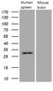 Proteinase 3 antibody, M03863-1, Boster Biological Technology, Western Blot image 