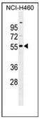 Ras Association Domain Family Member 8 antibody, AP53593PU-N, Origene, Western Blot image 
