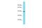 Olfactory Receptor Family 6 Subfamily C Member 1 antibody, A17015, Boster Biological Technology, Western Blot image 