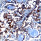 Ribosomal Protein S6 Kinase A1 antibody, AF992, R&D Systems, Immunohistochemistry paraffin image 