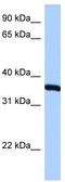 Ribosomal Protein Lateral Stalk Subunit P0 antibody, TA345694, Origene, Western Blot image 