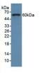 Collagen Type VIII Alpha 1 Chain antibody, LS-C301237, Lifespan Biosciences, Western Blot image 