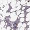 Keratin 81 antibody, NBP2-57133, Novus Biologicals, Immunohistochemistry frozen image 