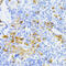 Matrix Metallopeptidase 2 antibody, 22-080, ProSci, Immunohistochemistry frozen image 