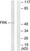 Fyn Related Src Family Tyrosine Kinase antibody, LS-C118893, Lifespan Biosciences, Western Blot image 